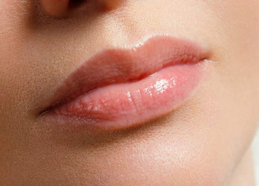 Affordable Lip Filler Injection in Bangladesh