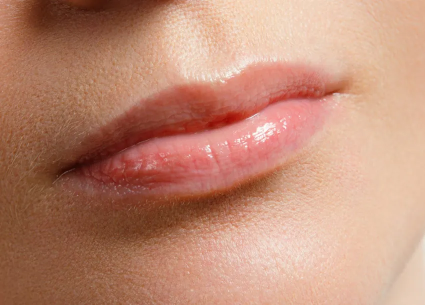 Affordable Lip Filler Injection in Bangladesh