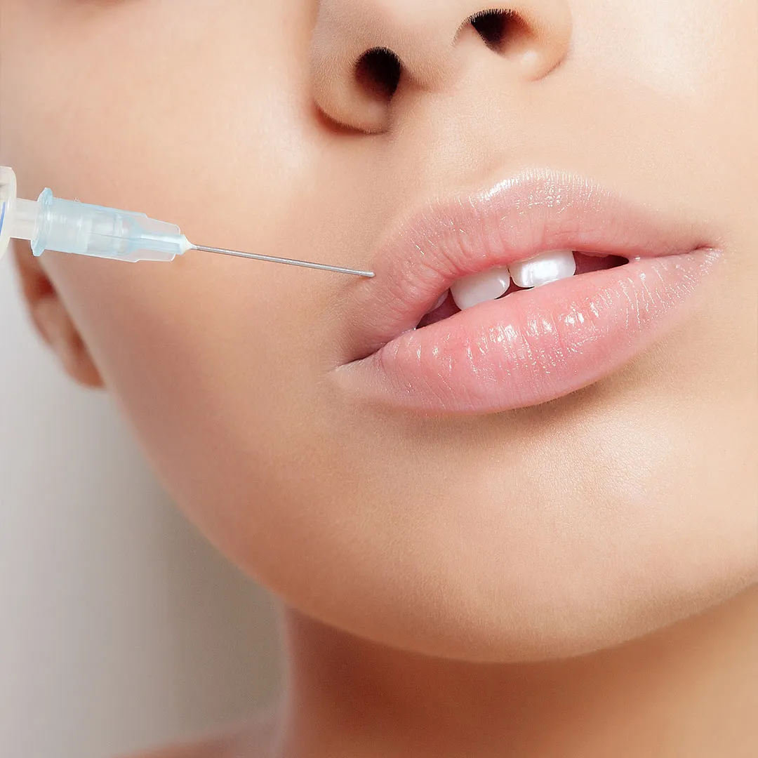 Lip filler injection Treatment
