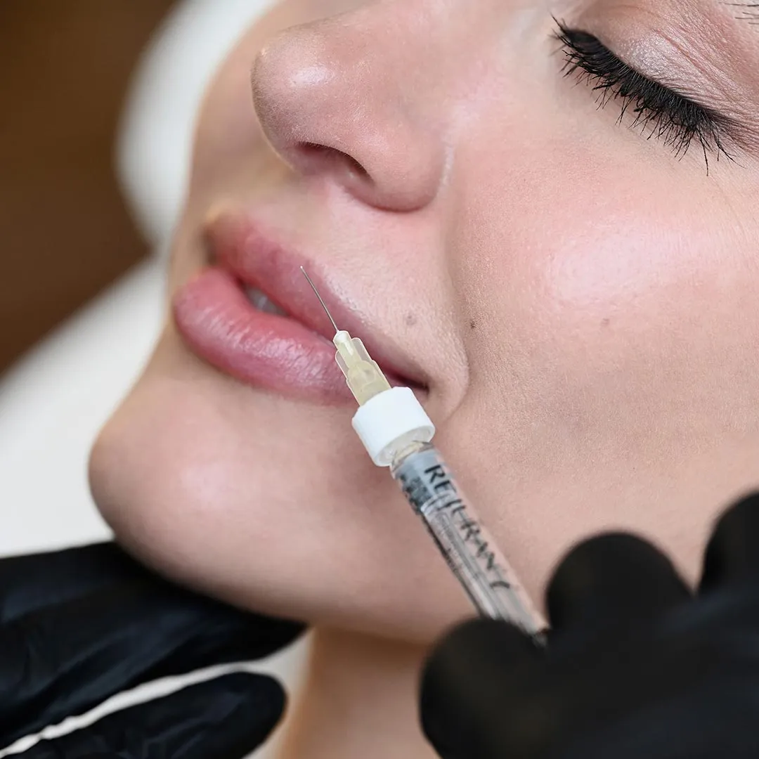 Dermal Filler Benefits
