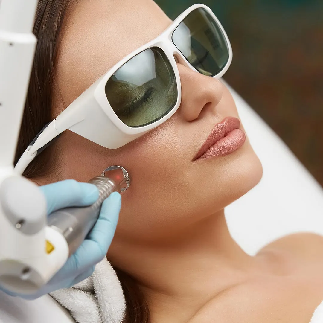 Freckles Removal Treatment