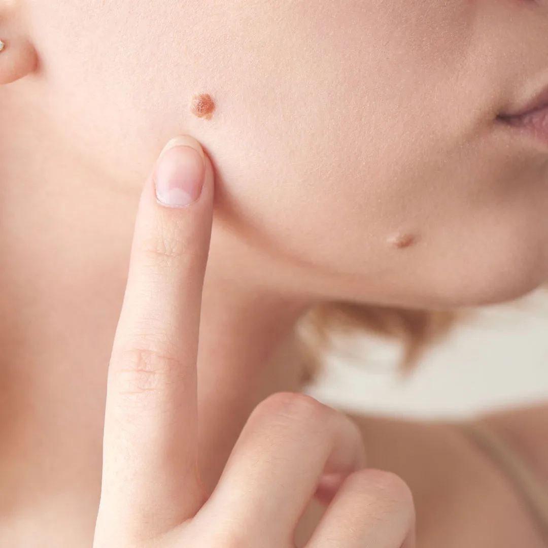 Til Remove From Face