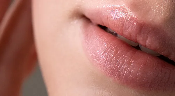 Dermal Filler in Dhaka Dermal Filler in Dhaka