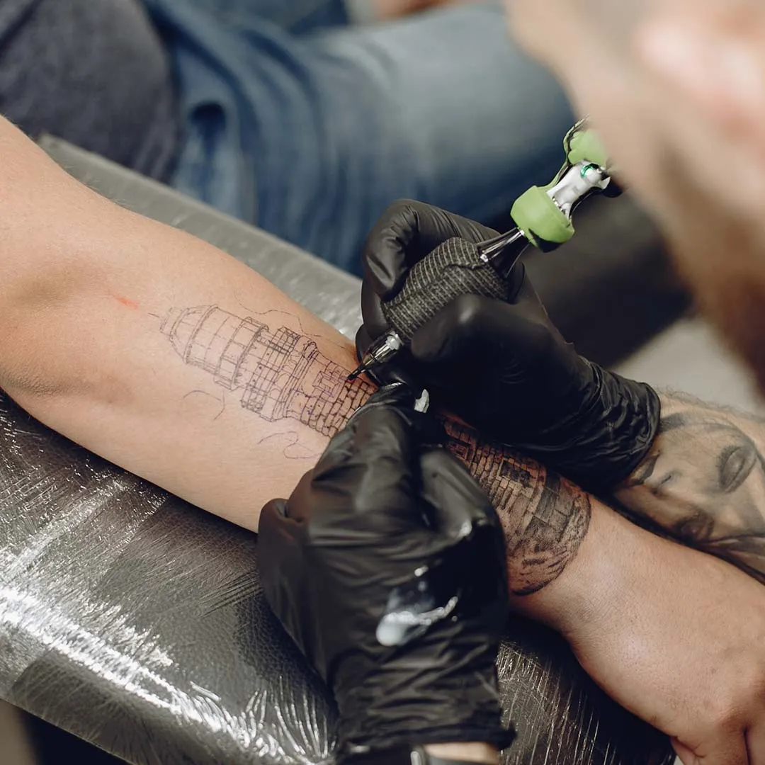 Customization For Tattoo Ink Removal