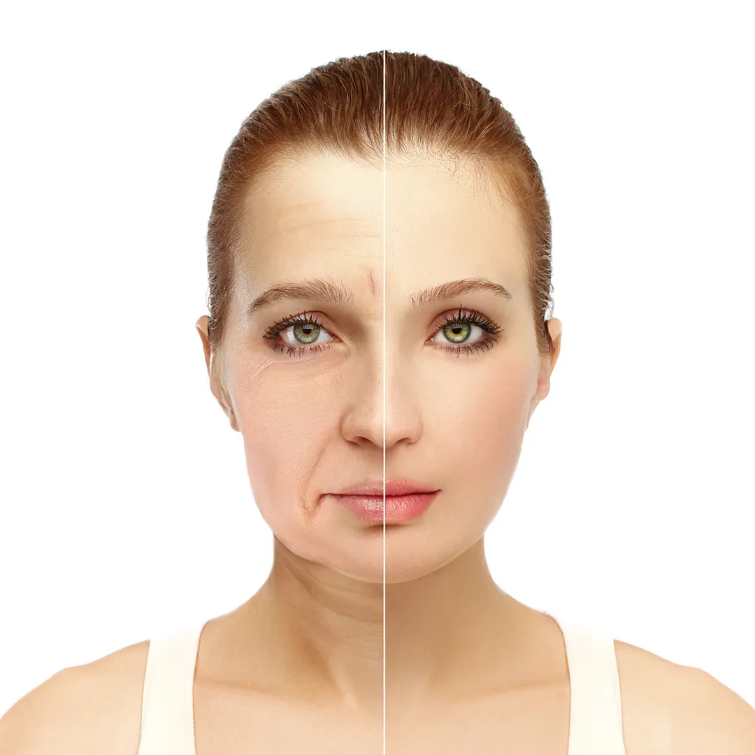Wrinkles Remove Treatment Benefits