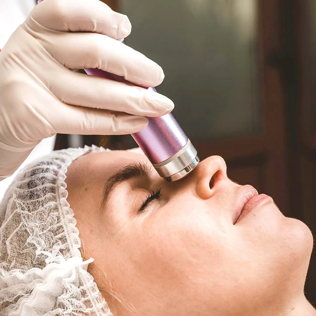 Acne Spot Removal