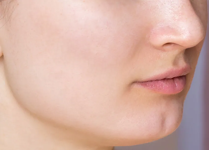 Acne Spot Removal