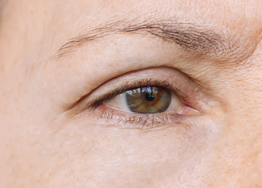 Carbon-dioxide Laser Treatment in Bangladesh