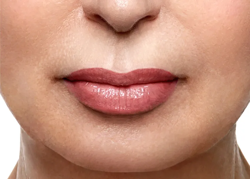Best Carbon-dioxide Laser Treatment