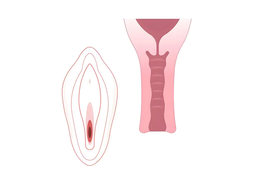 Private Part Tightening Before After