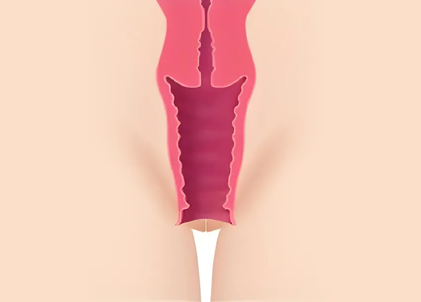 Best Vaginal Rejuvenation Treatment