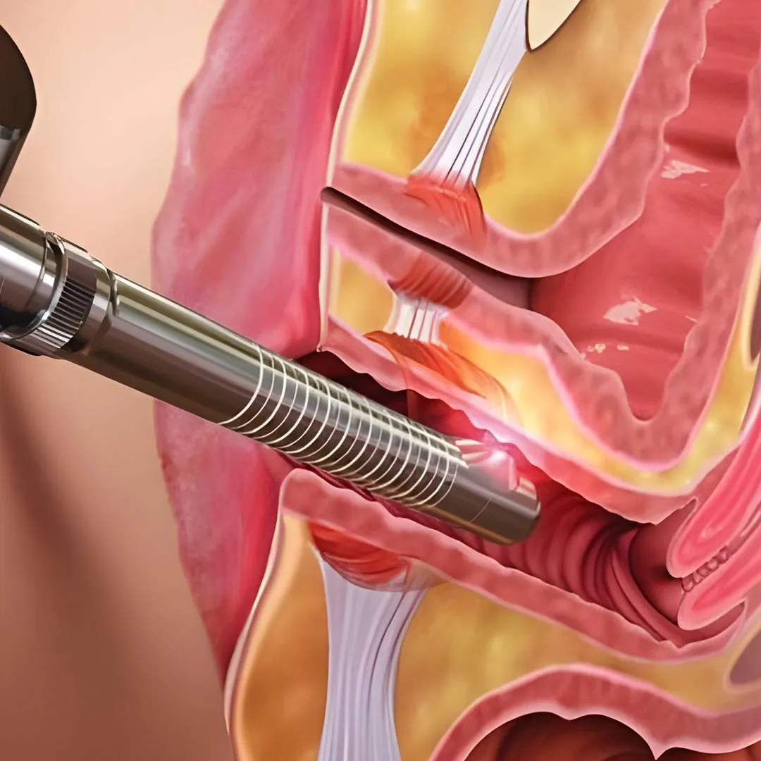 Private Part Tightening Care
