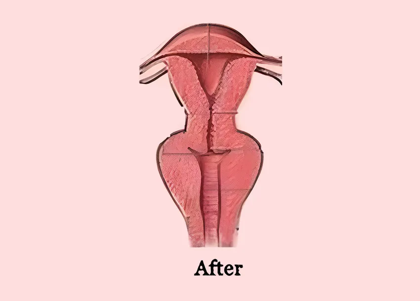 Best Vaginal Tightening Treatment