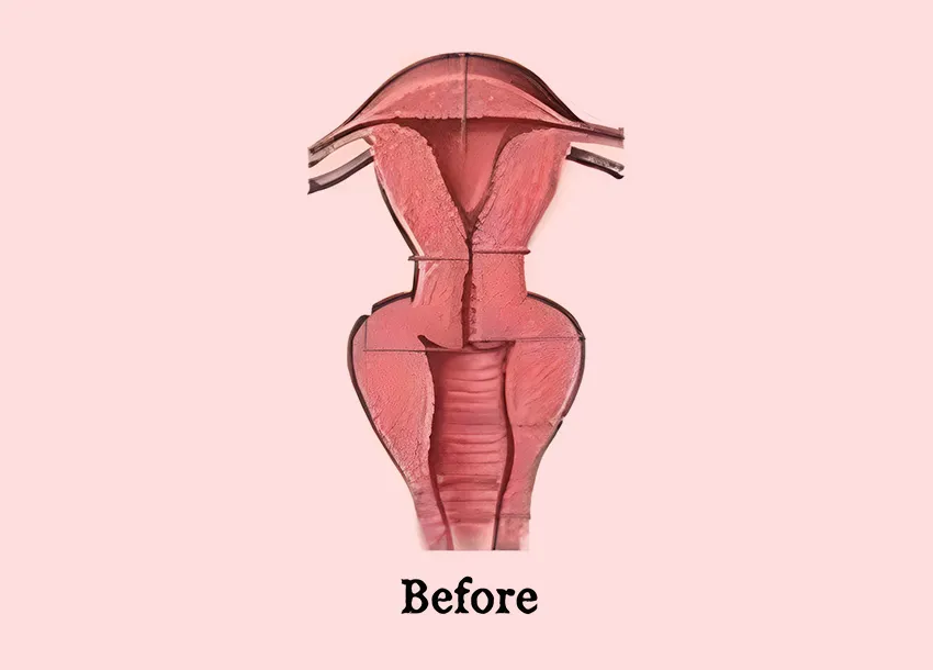 Private Part Tightening Care
