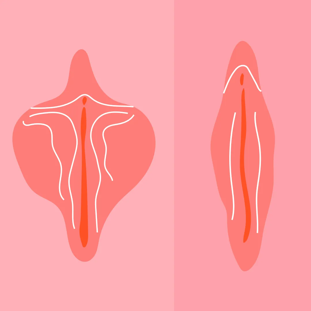 Laser Vaginal Tightening Before After
