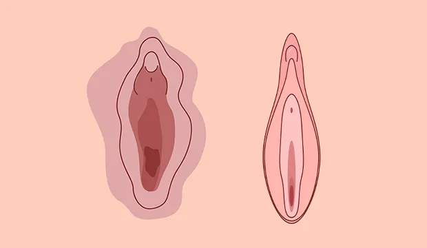Laser Vaginal Tightening Before After Laser Vaginal Tightening Before After