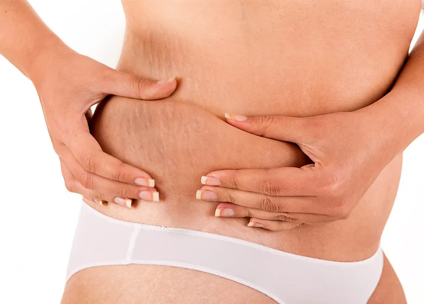 Female Personal Mark Removal Service Near Me