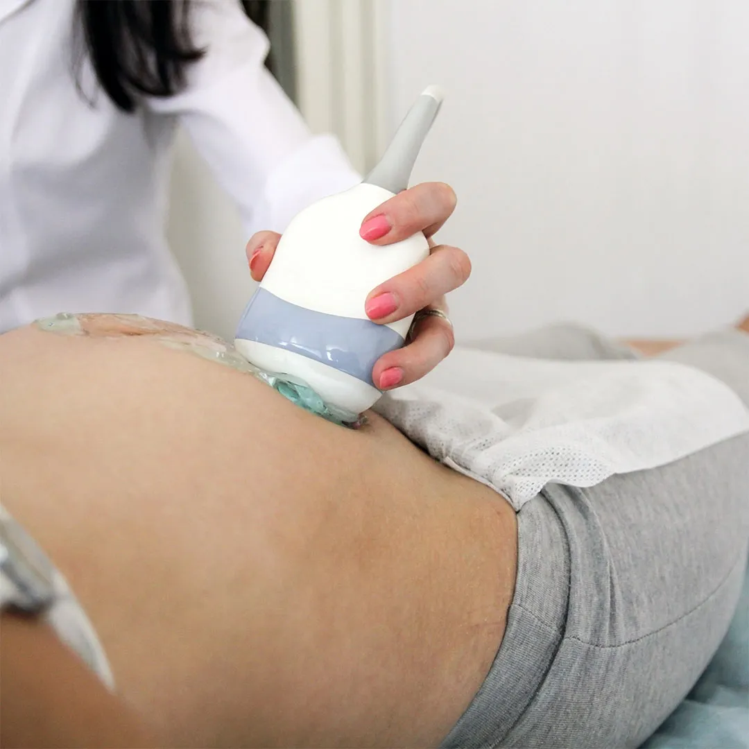 Best Pregnancy Mark Remove Treatment