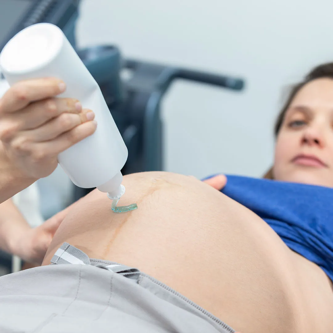 Best Pregnancy Mark Remove Treatment