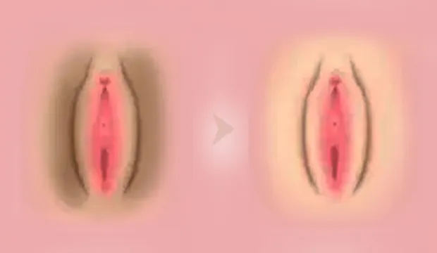 Women Private Part Solution