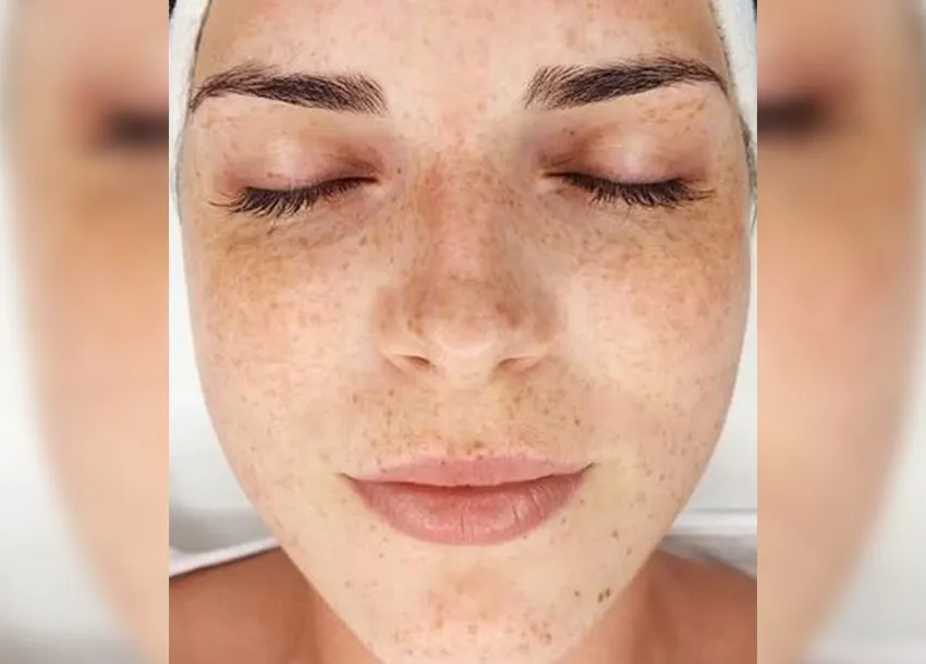 BB Glow Facial Before And After