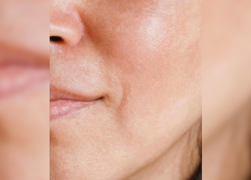 BB Glow Facial Before And After