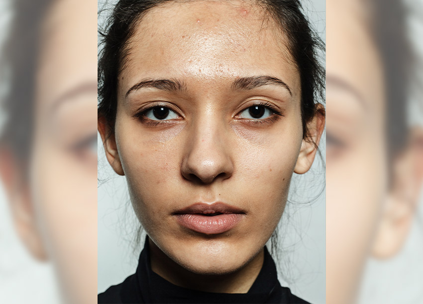 BB Glow Facial Before And After