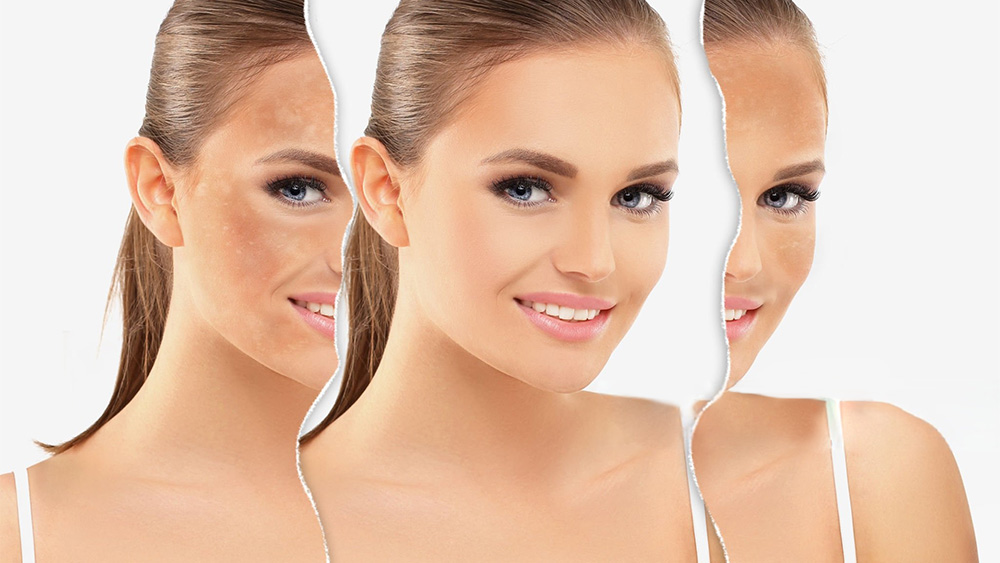Benefits Of Glutathione For Skin And Overall Health Benefits Of Glutathione Injections