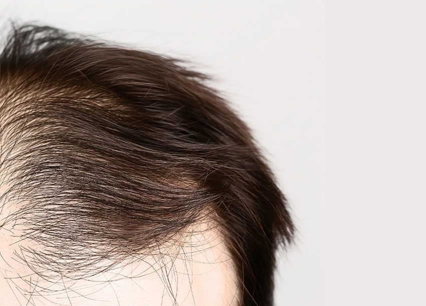 Hair Growth PRP Reviews
