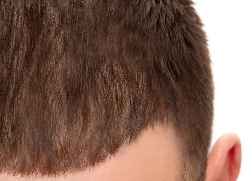 GFC Hair Growth Treatment Men