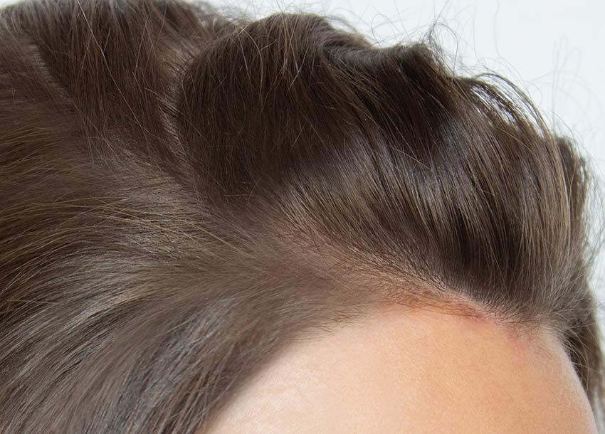 Collagen Hair Therapy for Men