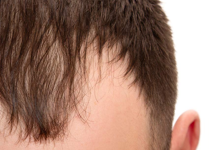 GFC Hair Growth Treatment Men