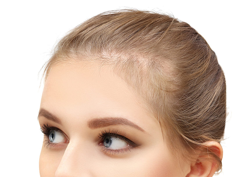 GFC Hair Growth Treatment For Women