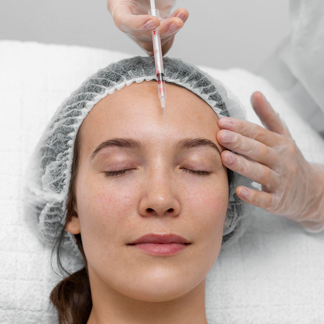 PRP Facial with Microneedling