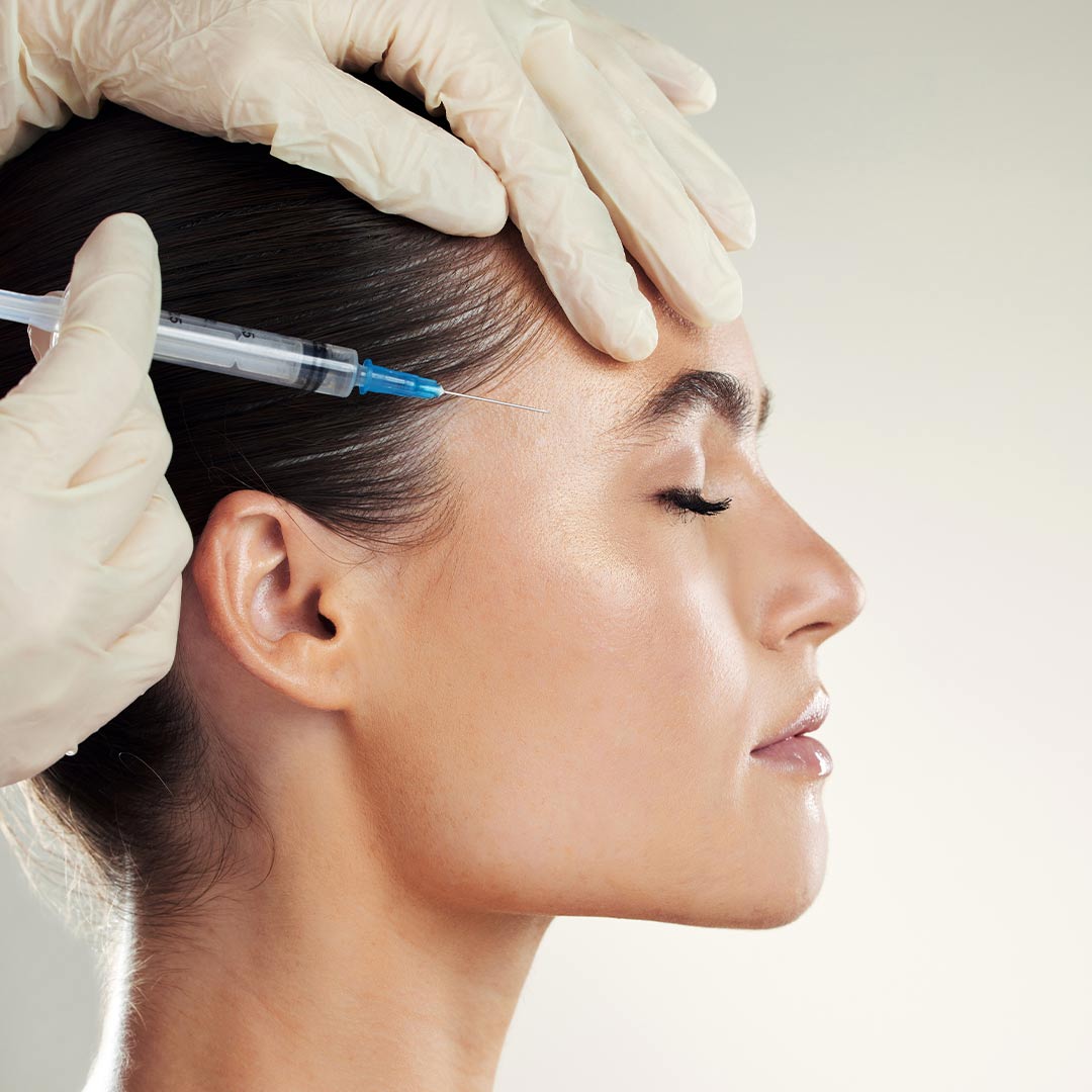 PRP with Microneedling