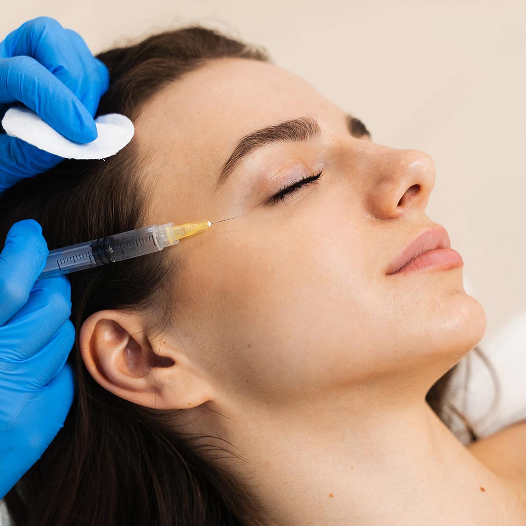 PRP Facial with Microneedling