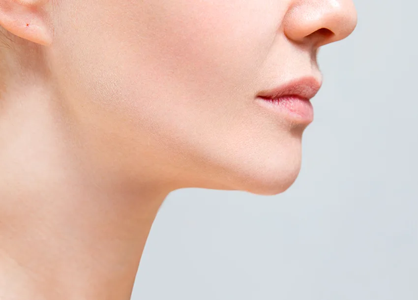 After Double Chin Removal