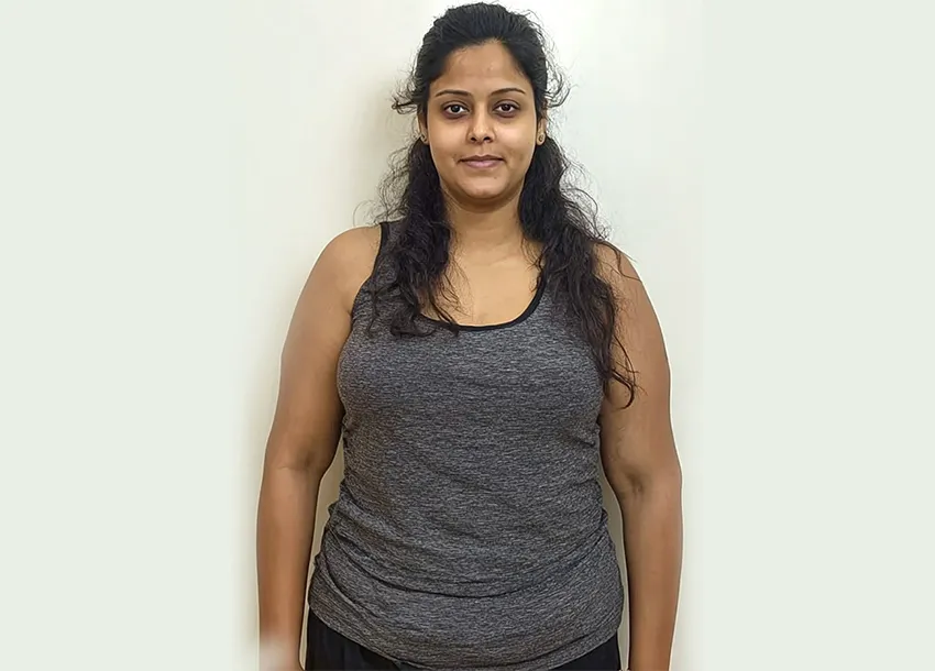 Before Belly Fat Reduce Treatment