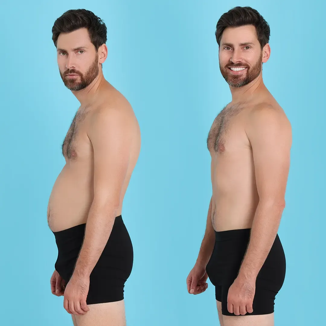 Lipo Laser Treatment Benefits