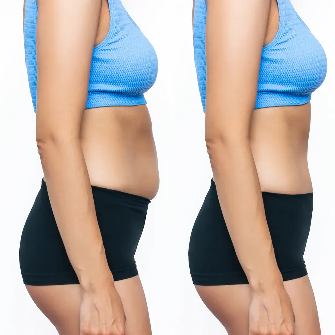 Belly Fat Reduce Reviews