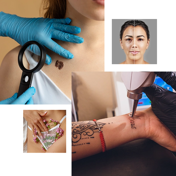 Skincare Treatments At Dhanmondi Skin and Laser Center Skincare Treatments At Dhanmondi Skin and Laser Center