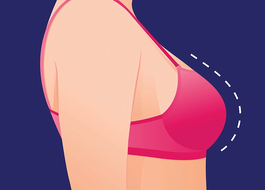 Breast Tightening Treatment Reviews