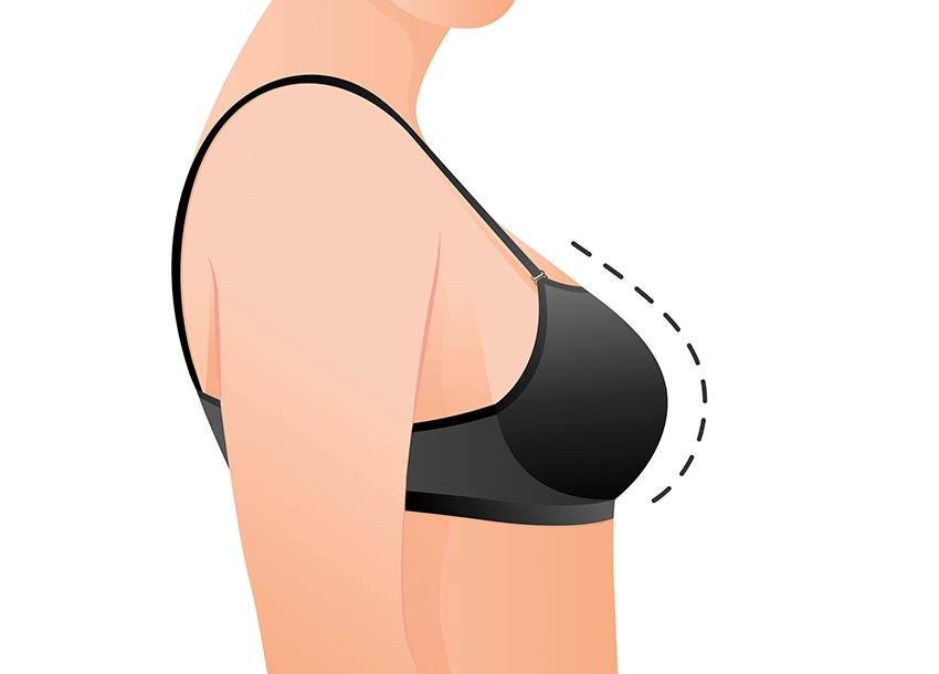 Breast Tightening Treatment Reviews