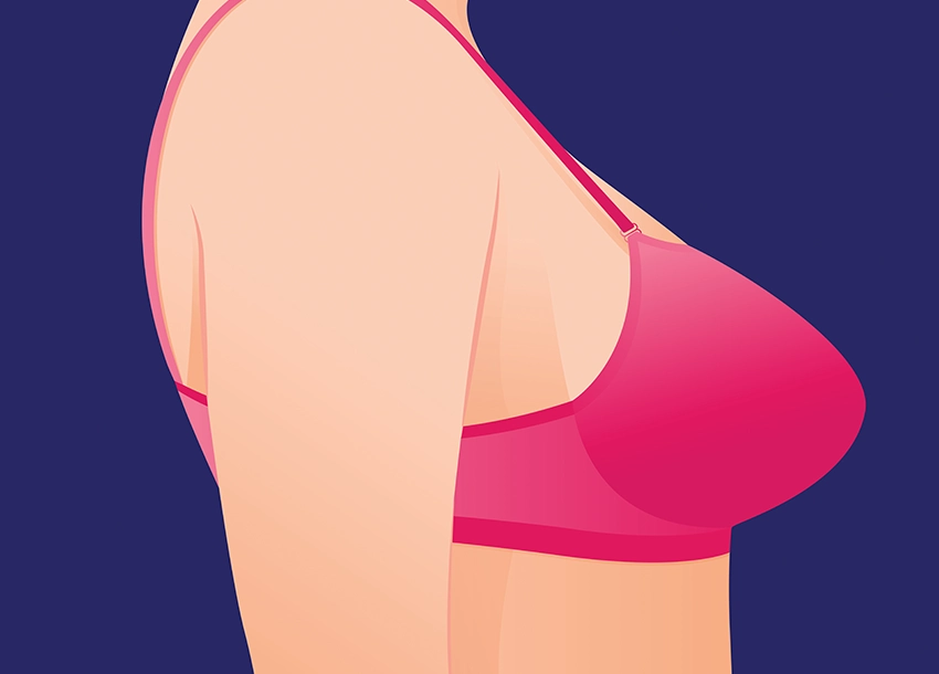 Before Breast Tightening Treatment