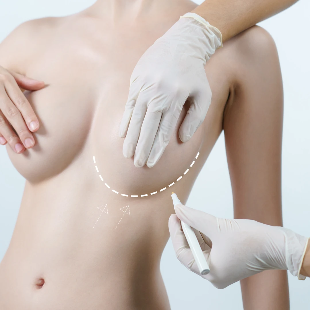 Breast Tightening Center in Dhaka