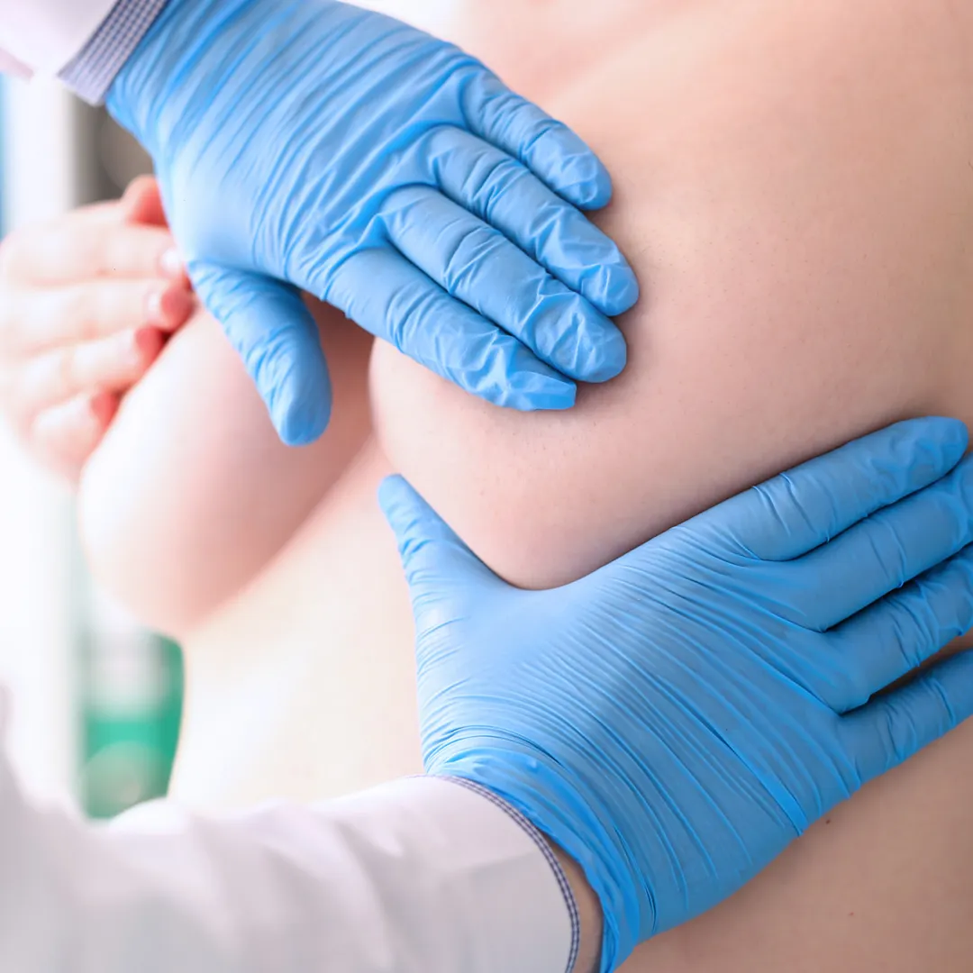 Expert Breast Tightening Service