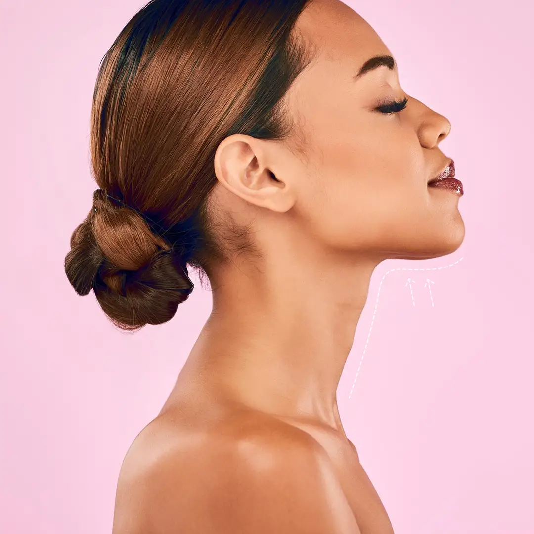 Double Chin Removal Benefits