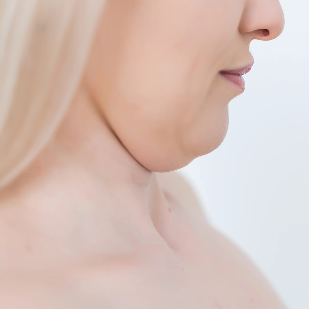Facial Fat