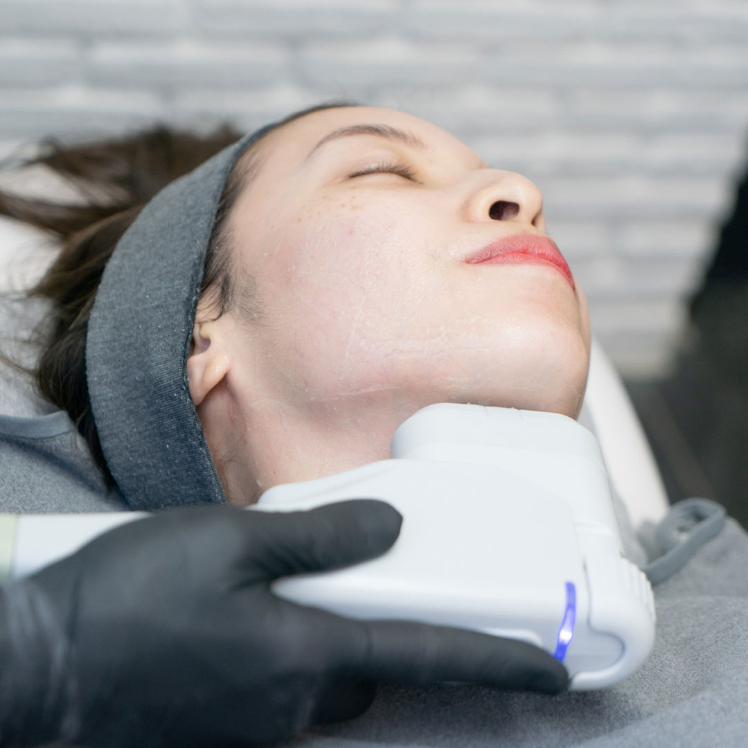 HIFU Non Surgical Face Fat Reduction Treatment