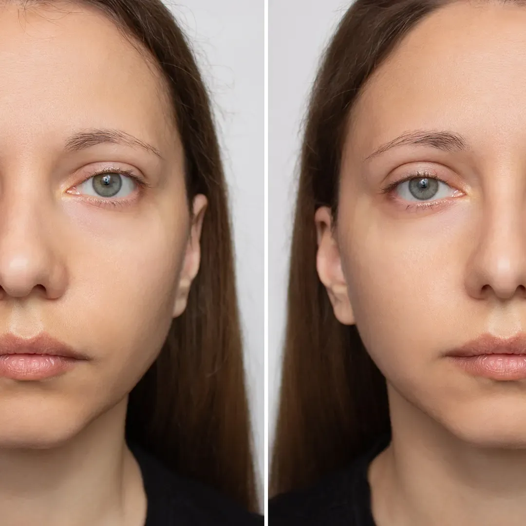 Face Fat Reduce Benefits Section 01